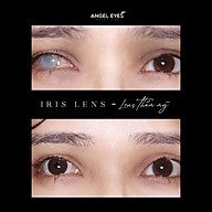Lens thẩm mỹ che khuyết điểm Angel Eyes dành cho mắt bị đục thủy tinh thế thumbnail