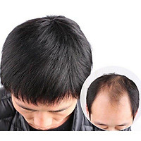 Tóc giả mái hói nam