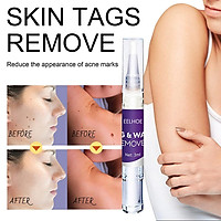 Skin Tag Removing Pen Against Remove Lighten Excess Genital Wart Moles Skin Tags Remover