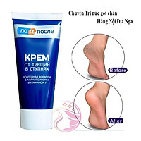 Kem dưỡng ngăn ngừa nứt gót chân Kpem Cream for Carcks in the feet 50ml