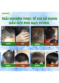 Dầu gội phủ bạc VONVI giúp tóc đen tự nhiên bóng rạng sau 10 phút với thiết kế lược chải đen tóc thông minh, không xót, không làm đen da đầu 200 ml