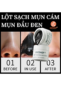 Gel Lột Mụn Nha Đam OKESHOP 30ml - Giải Pháp Loại Bỏ Mụn Đầu Đen - Mụn Cám - Bạ Nhờn - Làm Sạch Sâu Và Thu Nhỏ Lỗ Chân Lông
