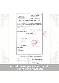 Lens trong suốt cận Angel Eyes Cosmo có độ từ 0 đến 15 độ, dòng kính áp tròng cận trong suốt có độ phù hợp mọi nhu cầu