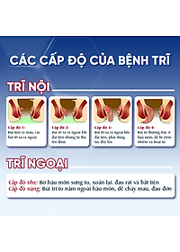 Viên Uống Hỗ Trợ Co Thắt Búi Trĩ Trimax Hủ 30 Viên Nguyên Liệu Từ Thiên Nhiên