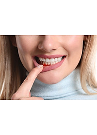 Cho máy Oral B Braun, bộ 4 Đầu Bàn Chải đánh răng điện thay thế MIHOCO EB60-P New Gum Care, sợi cước siêu mềm, cho răng lợi nhạy cảm