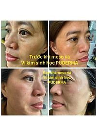 product-img-8