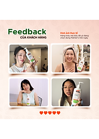 (Mini Size) Dưỡng thể ngừa rạn đầu thai kì 50ml