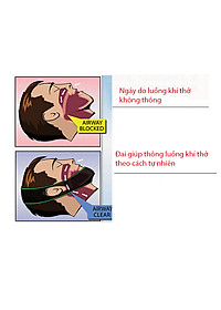 Đai nẹp cằm chống ngáy khi ngủ Stop Snoring belt Aolikes YE-2107