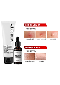 Bộ đôi giảm mụn sưng viêm Men Stay Simplicity cho nam Zinc PCA 1% + Terpineol-4 100g + 30ml