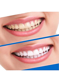 Full hộp 7 cặp - 14 miếng dán trắng răng 3D White Teeth Whitening Strips Sena Beauty, mạnh gấp 25 lần kem đánh răng