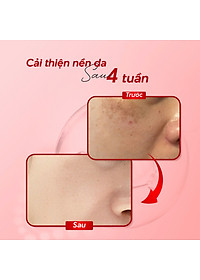 product-img-6