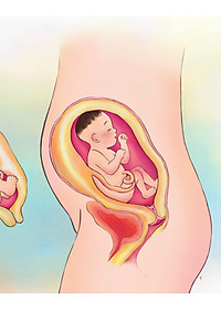 Sách Giáo Dục Giới Tính Và Nhân Cách Dành Cho Bé Gái - Tớ Biết Quý Trọng Cơ Thể Mình (Dạy Trẻ Cách Nhận Biết Và Bảo Vệ Các Bộ Phận Cơ Thể)