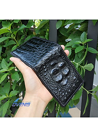 Ví Da Cá Sấu 2 Mặt Đan Viền [GÙ CÁ SẤU RẤT ĐẸP]