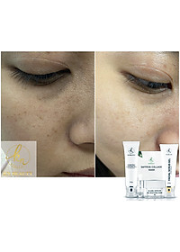 product-img-18