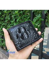 Ví Da Cá Sấu 2 Mặt Đan Viền [GÙ CÁ SẤU RẤT ĐẸP]