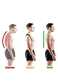 Đai Chống Gù Lưng Trẻ Em Học Sinh mi01 - Hàng Chính Hãng miDoctor