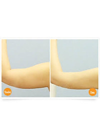 product-img-7