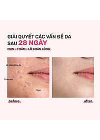 product-img-5
