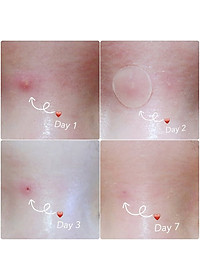 product-img-5
