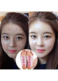 HỘP 50 miếng dán chân thải độc ,các chất cặn bã trong cơ thể qua gan bàn chân
