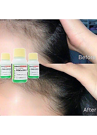 Tinh Chất Thảo Dược Kích Thích Mọc Tóc Ngăn Rụng Tóc Phục Hồi Tóc Hư Tổn Sato 30ml Nội địa Nhật Bản