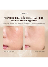 product-img-10