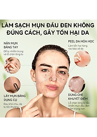 Gel Lột Mụn Than Tre Hoạt Tính OKESHOP 30ml - Giải Pháp Loại Bỏ Mụn Đầu Đen - Mụn Cám - Bạ Nhờn - Làm Sạch Sâu Và Thu Nhỏ Lỗ Chân Lông