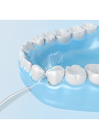 Máy tăm nước di động cầm tay làm sạch chống sâu răng Xiaomi Mijia Oral Irrigator Portable Water Dental