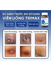 Viên Uống Hỗ Trợ Co Thắt Búi Trĩ Trimax Hủ 30 Viên Nguyên Liệu Từ Thiên Nhiên