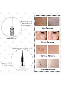 [Đẹp Tự Nhiên] Bút Xóa Đốt Nút Ruồi KhoNCC Hàng Chính Hãng - Tàn Nhang - Mụn Cóc - Thịt Dư - Có Đèn Led Hiển Thị Tự Làm Đẹp Hiệu Quả Một Cách Bất Ngờ - KLVQ-324-BXTN