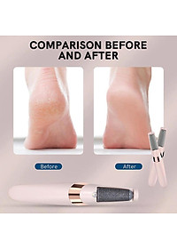 Máy Chà Gót Chân, Tẩy Tế Bào Chết Cho Tiệm Nail, Cá Nhân Tại Nhà Cao Cấp Sạc Tích Giảm Vết Chai Sạn Điện Làm Mịn Da