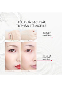 Nước tẩy trang Evoluderm Micellar Cleansing Water 250ml