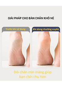 Máy chà da chết gót chân Enchen Rock làm mềm cục chai nứt nẻ gót chân, khuỷu tay - Tặng kèm 2 miếng chà