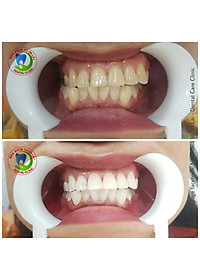 product-img-4