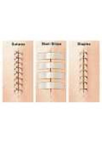 Set 3 vỉ 30 miếng dán thay chỉ khâu da 3M Steri-strip™ R1546 – Size 6mm x 100mm | Sản xuất tại Mỹ