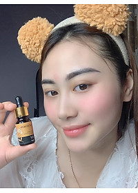 Serum trị mụn kén tằm Newskin - Chuyên hỗ trợ điều trị và phục hồi da mụn