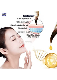 Cạo gió sừng đen (MH824) Masssage toàn thân, giúp tuần hoàn khí huyết - Chăm sóc sức khỏe