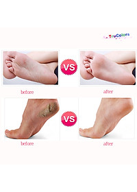 Máy chà gót chân, tẩy sạch da chết dùng cá nhân và tiệm nail, spa