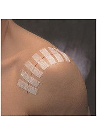 Set 3 vỉ 30 miếng dán thay chỉ khâu da 3M Steri-strip™ R1546 – Size 6mm x 100mm | Sản xuất tại Mỹ