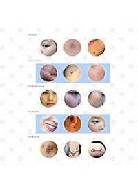 [Đẹp Tự Nhiên] Bút Xóa Đốt Nút Ruồi KhoNCC Hàng Chính Hãng - Tàn Nhang - Mụn Cóc - Thịt Dư - Có Đèn Led Hiển Thị Tự Làm Đẹp Hiệu Quả Một Cách Bất Ngờ - KLVQ-324-BXTN