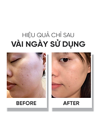 Tinh chất dưỡng trắng da Lá House Astalock Concentrated Essence 15ml/30ml