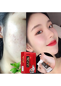 HỘP 50 miếng dán chân thải độc ,các chất cặn bã trong cơ thể qua gan bàn chân