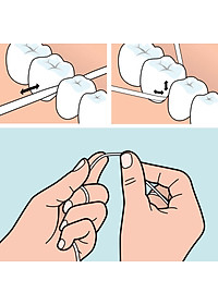 Chỉ nha khoa hương bạc hà Tepe Dental Floss 40m (cuộn 40m)