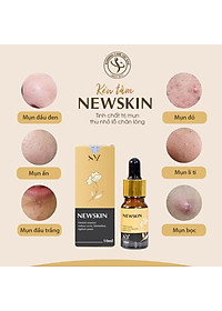 Serum trị mụn kén tằm Newskin - Chuyên hỗ trợ điều trị và phục hồi da mụn