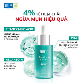 Serum dưỡng ẩm cho da mụn, nhạy cảm Hada Labo Acne Care Calming Serum 30ml
