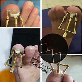 (LOẠI TỐT NHẤT) Bộ niềng móng chân dụng cụ chữa móng chân quặp đâm vào khóe móng
