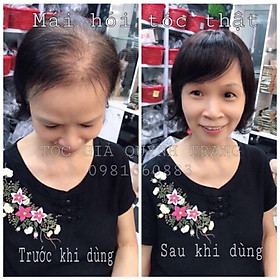  TÓC CHE HÓI CAO CẤP CÓ DA DẦU CÓ MÁI