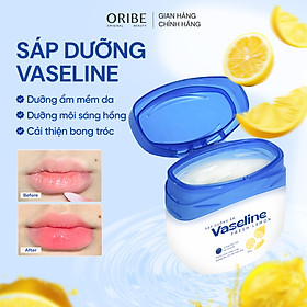 Sáp dưỡng đa năng Vaseline dưỡng ẩm giảm tình trạng da khô nứt nẻ