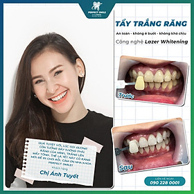 Hình ảnh E-voucher Tẩy trắng răng công nghệ Laser Whitening