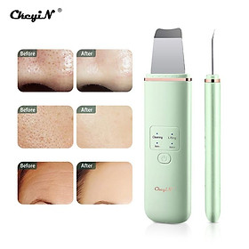 Máy Tẩy Tế Bào Chết CkeyiN Siêu Âm EMS Ion Sạc Pin Loại Bỏ Mụn Đầu Đen Trên Da Mặt